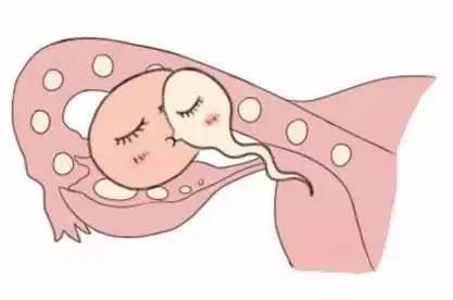 代生选性别包生男孩